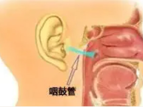 全國(guó)愛(ài)耳日 專家談急性化膿性中耳炎